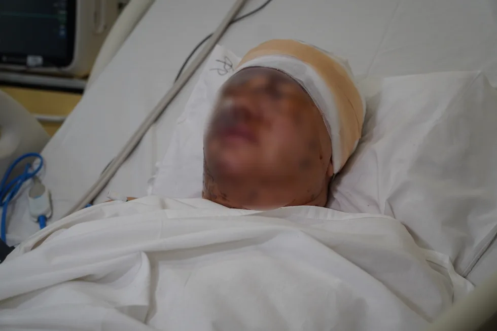Самотужки виповзала з-під завалів. У якому стані поранена касирка АЗС з Нікополя, по якій влучили дроном