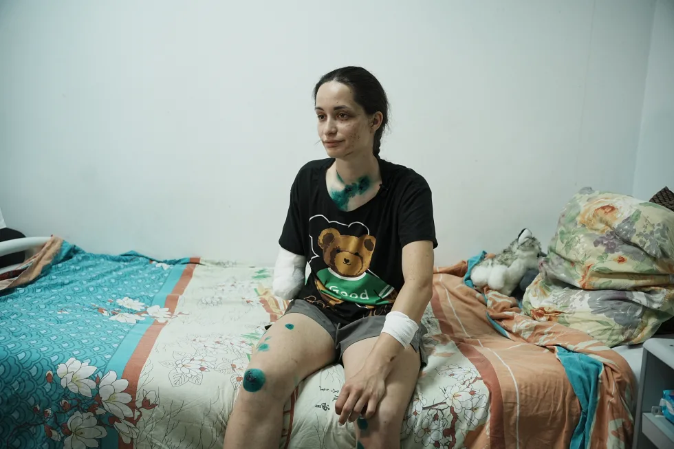 "Я не відчуваю, що у мене немає руки": як відновлюється 21-річна рятувальниця з Харкова Олександра Щебілова
